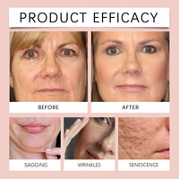 Hoygi Collagen Peel-Off Mask – Glass Skin Glow, Pore Tightening & Deep Hydration | 75g | CPNP Certified